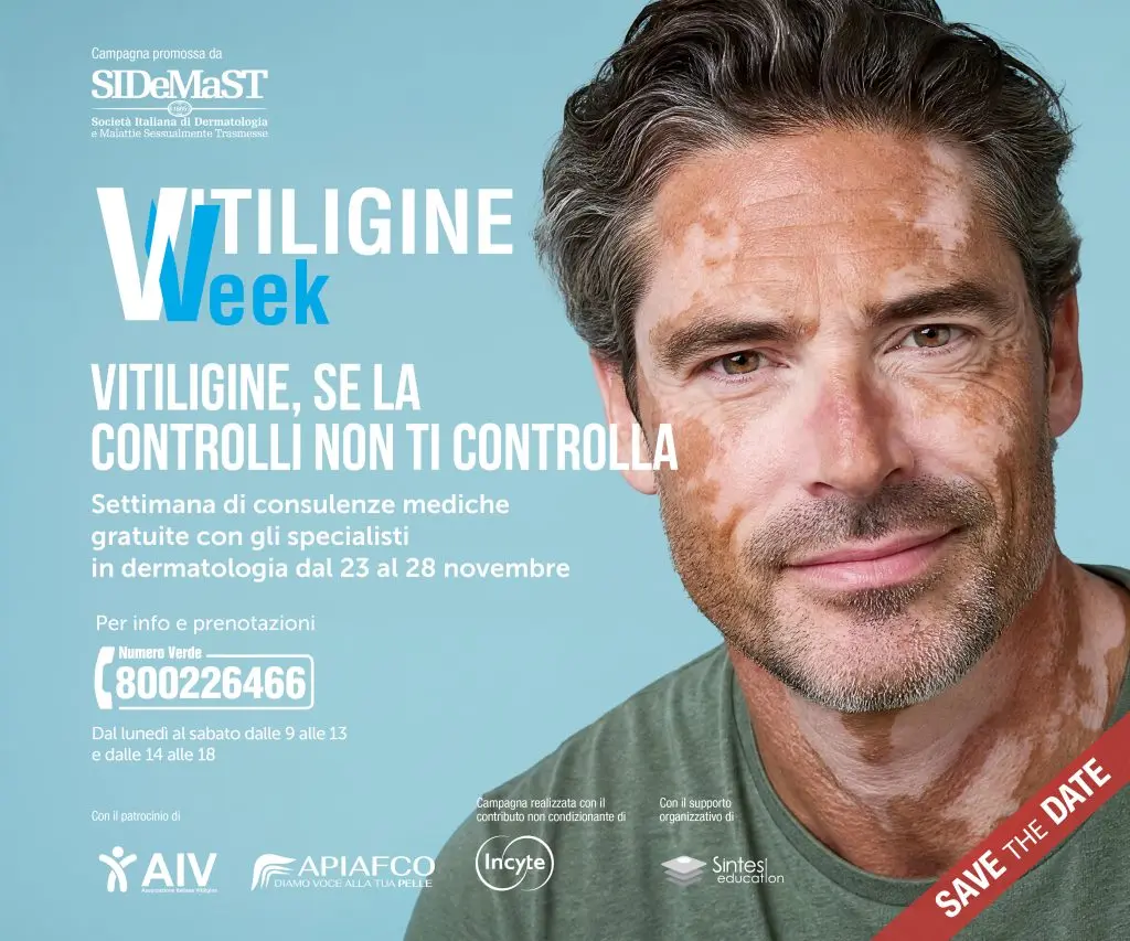 Vitiligine Week 2026, un uomo affetto da vitiligine si mostra sereno e sicuro di sè, in primo i piano le informazioni sulla campagna